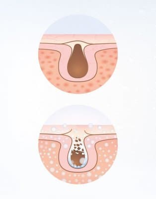 Ansiktssauna facial care lanaform