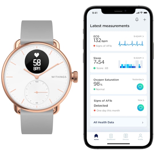 Withings ScanWatch Hybrid smartwatch 38mm (roséguld)