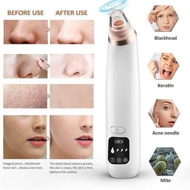 Mr. Blackhead remover - Suger ut pormaskar