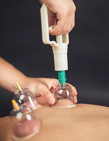 Koppning med vakuumpump för behandling och massage 12 st
