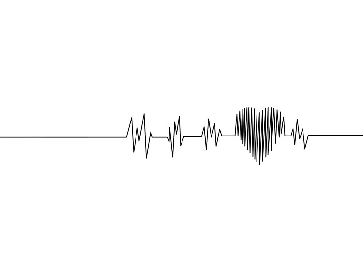 En svart linjepå vit bakgrund som går upp och ner för att illustrera en hjärtfrekvens. 